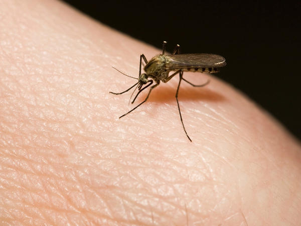 El virus zika es causado por la picadura de un mosquito y se cataloga como un arbovirus perteneciente al género flavivirus.